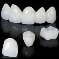 types of crowns zirconia 500x424 1 200x200 1